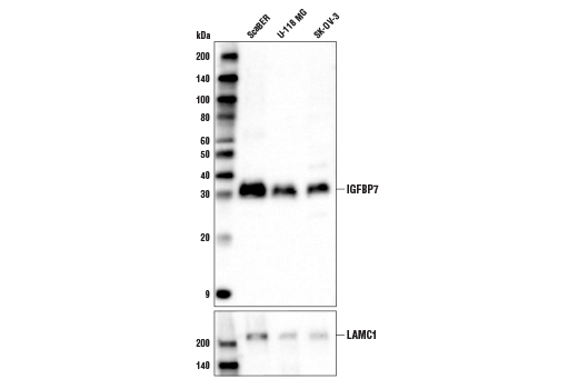 Western Blotting Image 1: IGFBP7 Antibody