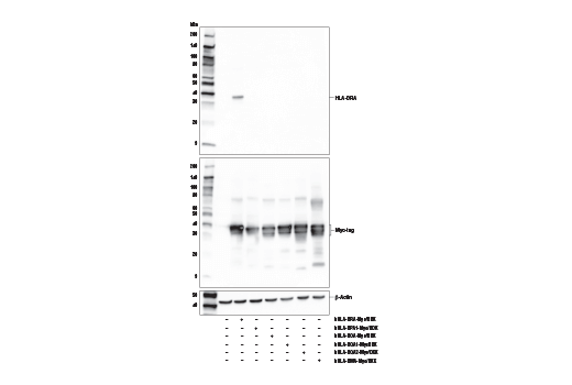 Image 9: Human Reactive M1 vs M2 Macrophage IHC Antibody Sampler Kit
