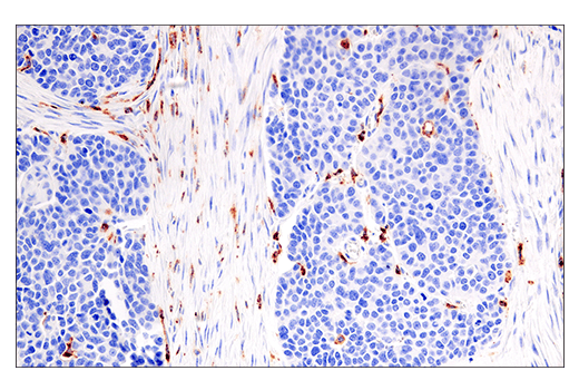  Image 28: Human Reactive M1 vs M2 Macrophage IHC Antibody Sampler Kit