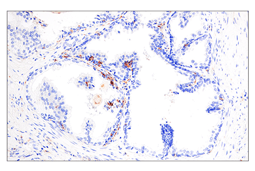  Image 37: Human Reactive M1 vs M2 Macrophage IHC Antibody Sampler Kit