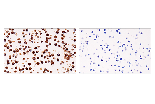  Image 44: Human Reactive M1 vs M2 Macrophage IHC Antibody Sampler Kit