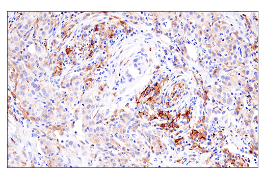  Image 48: Human Reactive M1 vs M2 Macrophage IHC Antibody Sampler Kit