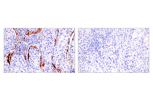  Image 52: Human Reactive M1 vs M2 Macrophage IHC Antibody Sampler Kit
