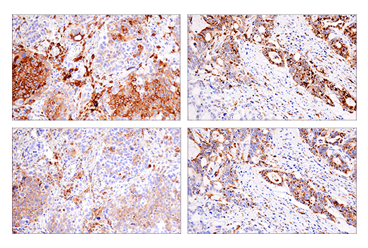  Image 64: Human Reactive M1 vs M2 Macrophage IHC Antibody Sampler Kit