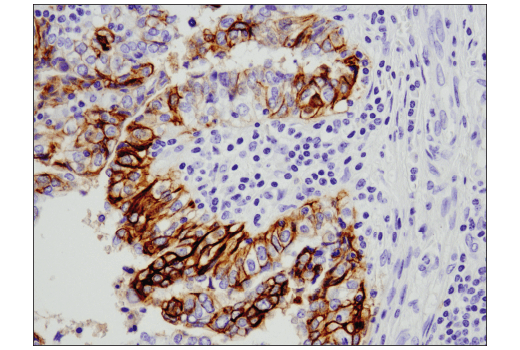 Immunohistochemistry Image 5: NCAM-L1 (D5D3K) Rabbit mAb (BSA and Azide Free)