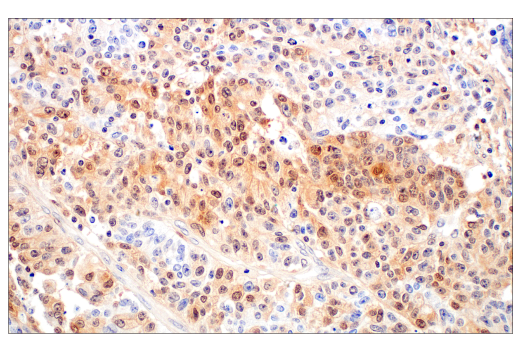 Immunohistochemistry Image 3: Caspase-1 (E4R8K) Rabbit mAb