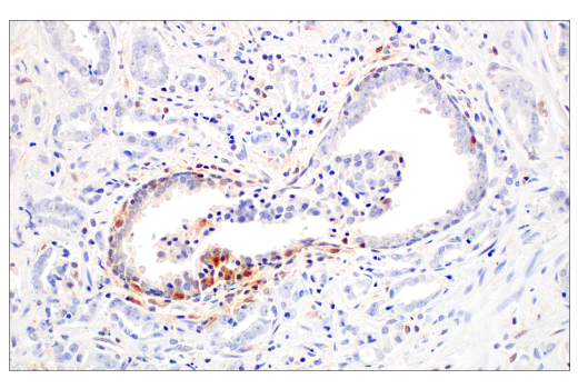 Immunohistochemistry Image 4: Caspase-1 (E4R8K) Rabbit mAb