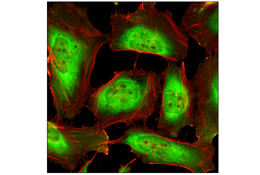 Immunofluorescence Image 1: HSP90 (C45G5) Rabbit mAb (BSA and Azide Free)