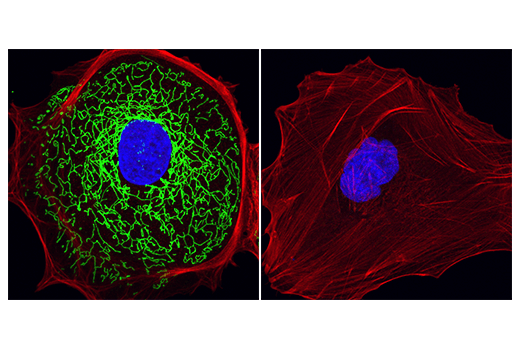 Immunofluorescence Image 1: MTHFD2 (E7A4L) XP® Rabbit mAb