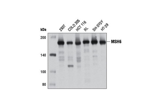 Western Blotting Image 1: MSH6 (3E1) Mouse mAb (BSA and Azide Free)