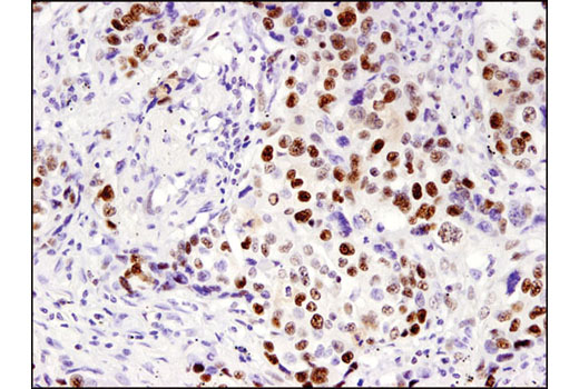 Immunohistochemistry Image 2: MSH6 (3E1) Mouse mAb (BSA and Azide Free)