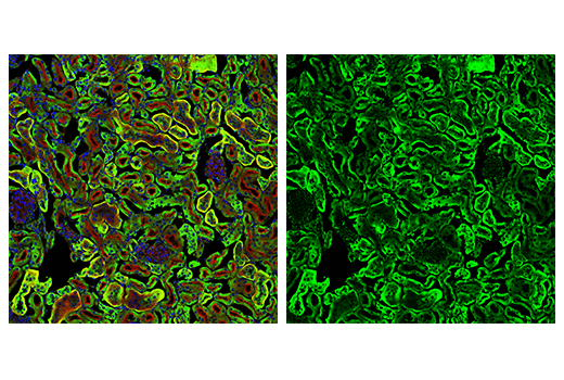 Immunofluorescence Image 2: MAVS (E8Z7M) Rabbit mAb (BSA and Azide Free)