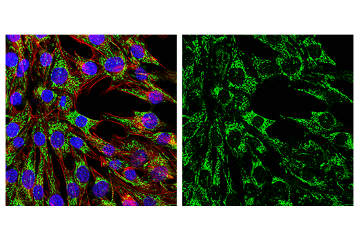 Immunofluorescence Image 5: MAVS (E8Z7M) Rabbit mAb (BSA and Azide Free)