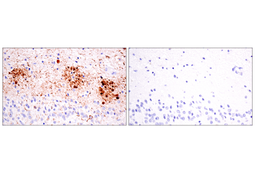 Immunohistochemistry Image 6: Phospho-Tau (Thr205) (E3E3B) Mouse mAb (BSA and Azide Free)