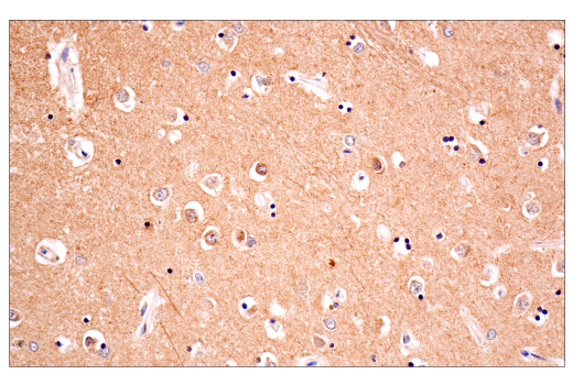 Immunohistochemistry Image 5: Phospho-Tau (Thr205) (E3E3B) Mouse mAb (BSA and Azide Free)