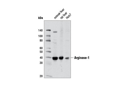 Western Blotting Image 1: Arginase-1 Antibody