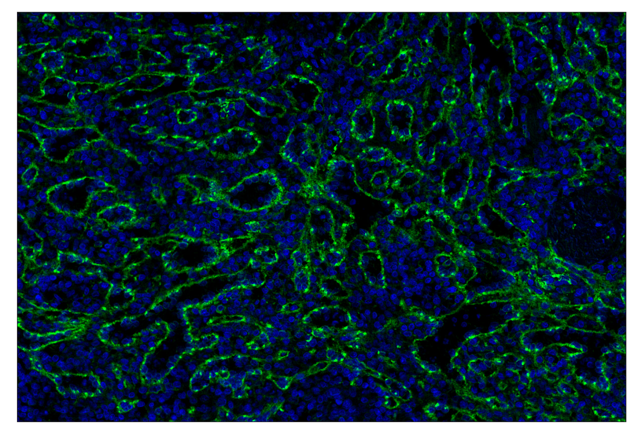 Immunohistochemistry Image 2: CD206/MRC1 (E2L9N) Rabbit mAb (Alexa Fluor® 488 Conjugate)