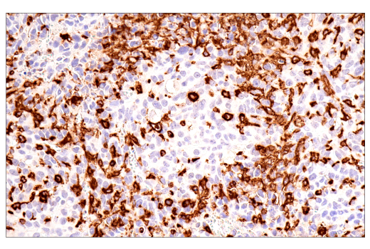 Immunohistochemistry Image 1: MSR1 (E7P6W) Rabbit mAb