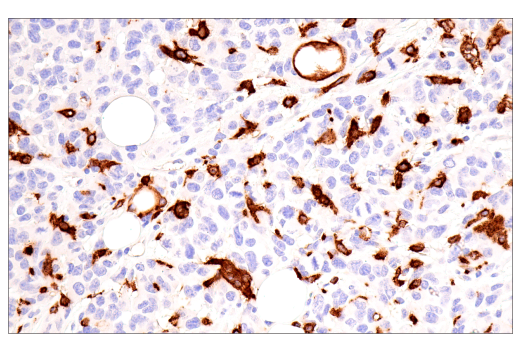 Immunohistochemistry Image 2: MSR1 (E7P6W) Rabbit mAb