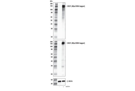 Western Blotting Image 1: CD21/CR2 Antibody
