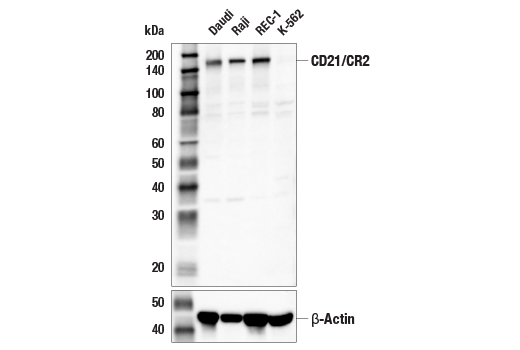 Western Blotting Image 2: CD21/CR2 Antibody