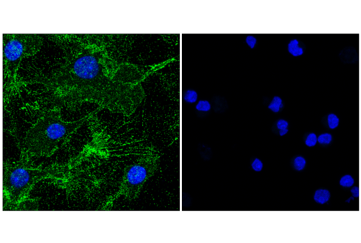 Immunofluorescence Image 1: CD9 (E8L5J) Rabbit mAb