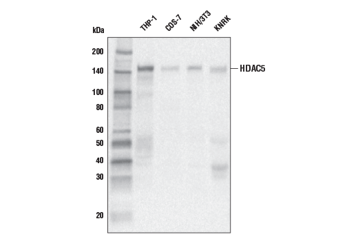 Western Blotting Image 1: HDAC5 (E6G3N) Mouse mAb