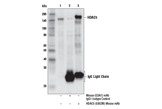 Immunoprecipitation Image 1: HDAC5 (E6G3N) Mouse mAb