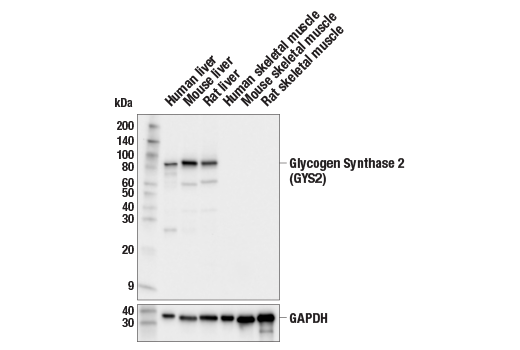 Western Blotting Image 1: Glycogen Synthase 2 (GYS2) Antibody