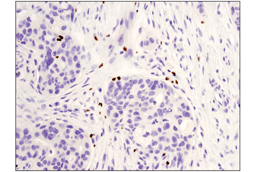 Immunohistochemistry Image 1: FoxP3 (D2W8E™) Rabbit mAb