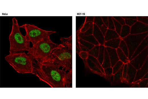 Immunofluorescence Image 1: ID3 (D16D10) Rabbit mAb