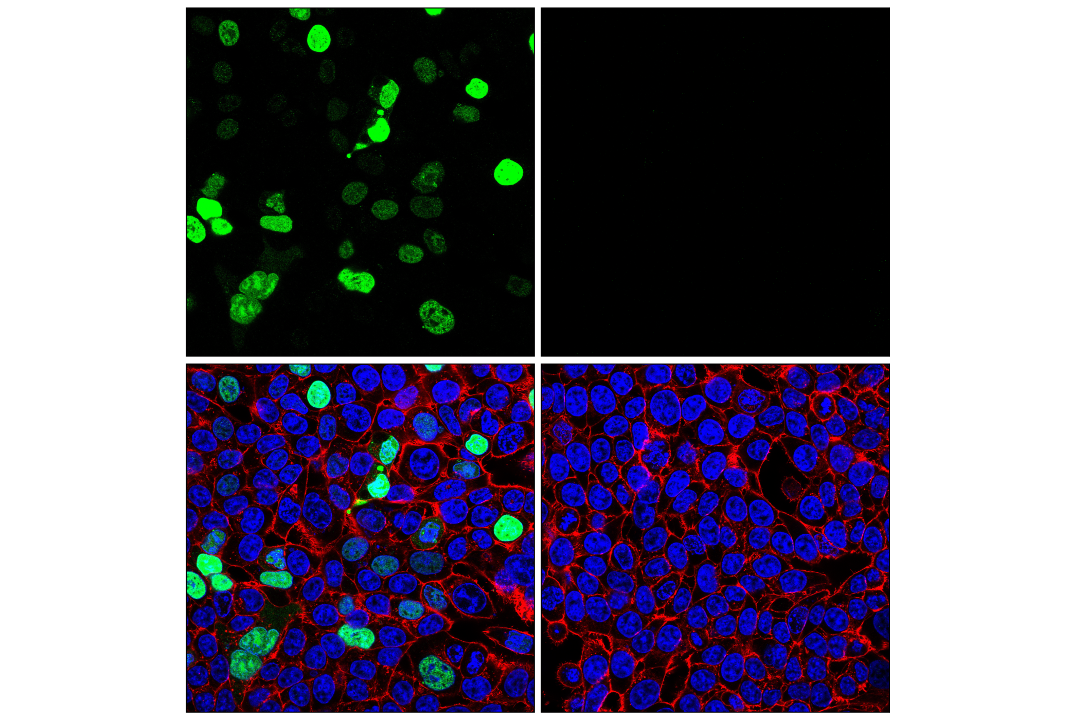 Immunofluorescence Image 2: Histone H3 (K36M Mutant Specific) (E8N1L) Rabbit mAb