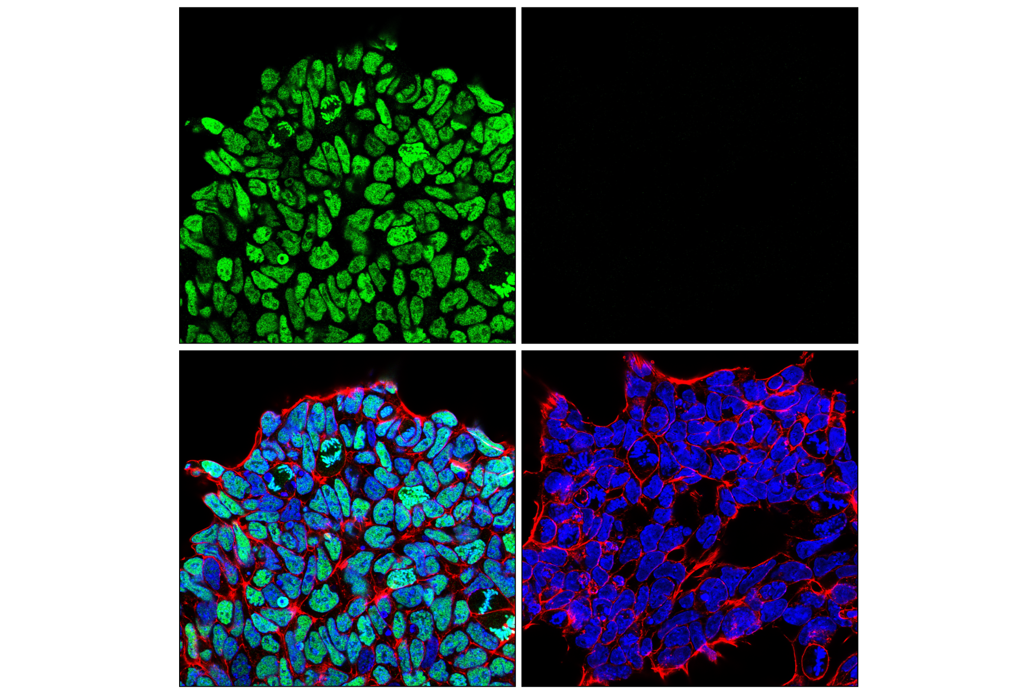 Immunofluorescence Image 1: Histone H3 (K36M Mutant Specific) (E8N1L) Rabbit mAb