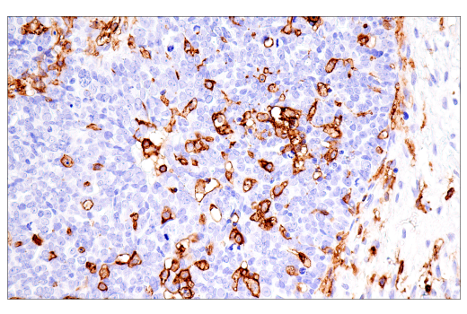 Immunohistochemistry Image 5: FcRγ (E6Y1A) Rabbit mAb (BSA and Azide Free)