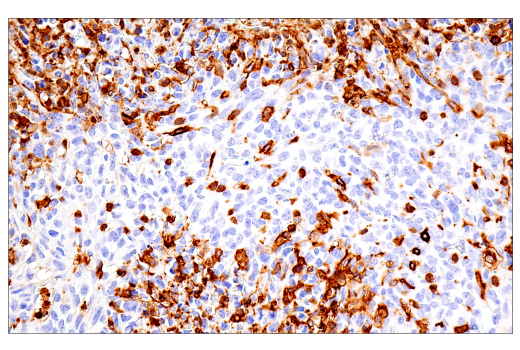 Immunohistochemistry Image 13: FcRγ (E6Y1A) Rabbit mAb (BSA and Azide Free)