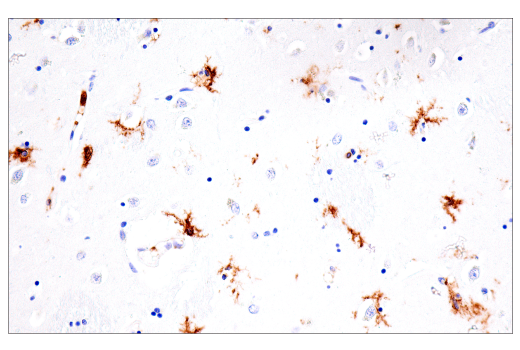 Immunohistochemistry Image 10: FcRγ (E6Y1A) Rabbit mAb (BSA and Azide Free)