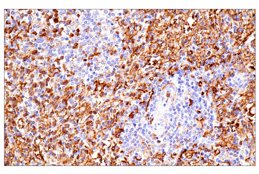 Immunohistochemistry Image 7: FcRγ (E6Y1A) Rabbit mAb (BSA and Azide Free)