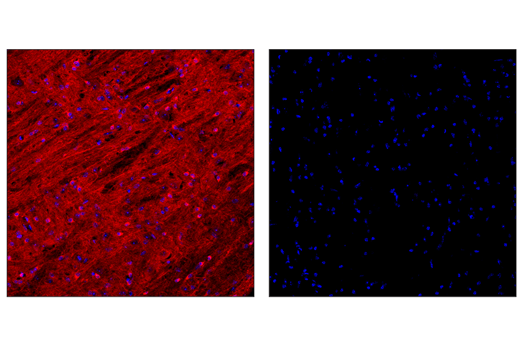 Immunofluorescence Image 1: Phospho-Tau (Ser404) (D2Z4G) Rabbit mAb (Alexa Fluor® 647 Conjugate)