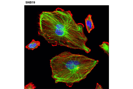 Immunofluorescence Image 1: Vimentin (D21H3) XP® Rabbit mAb (Alexa Fluor® 488 Conjugate)