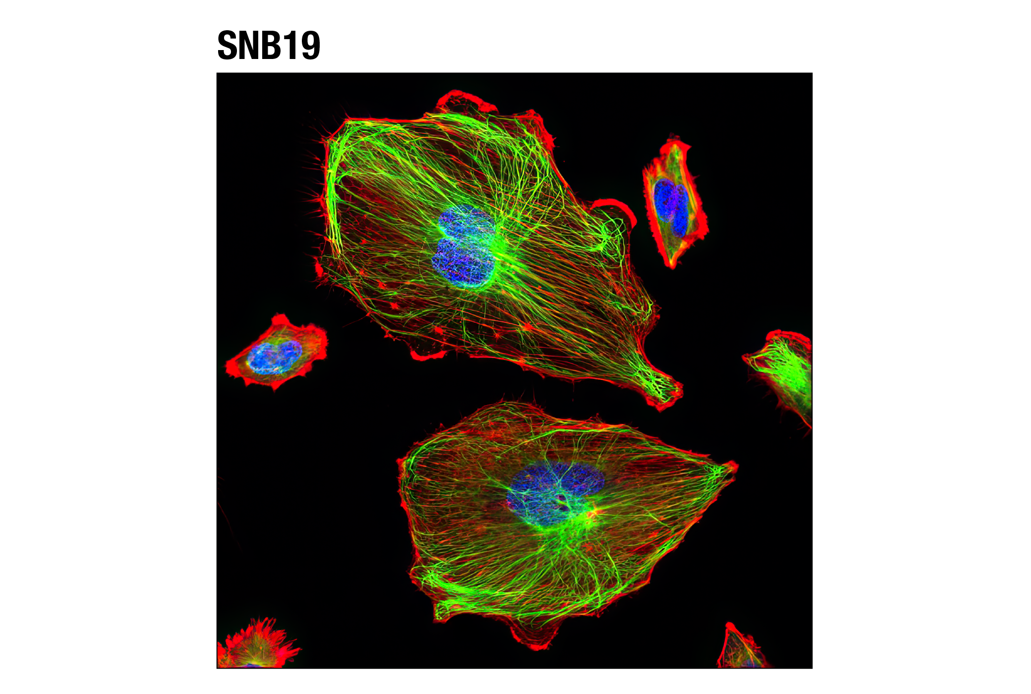 Immunofluorescence Image 1: Vimentin (D21H3) XP® Rabbit mAb (Alexa Fluor® 488 Conjugate)