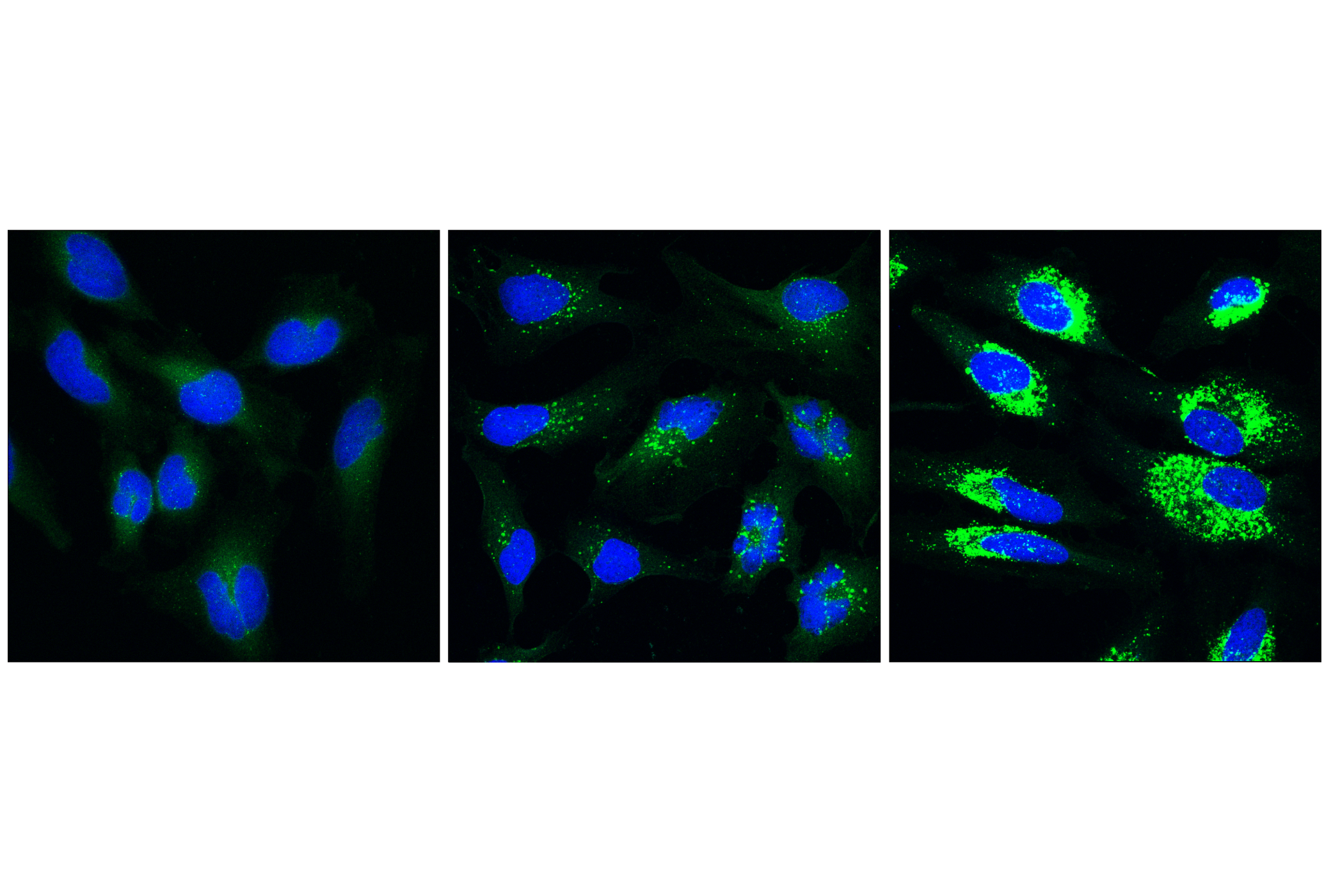 Immunofluorescence Image 1: LC3B (E5Q2K) Mouse mAb (Alexa Fluor® 488 Conjugate)