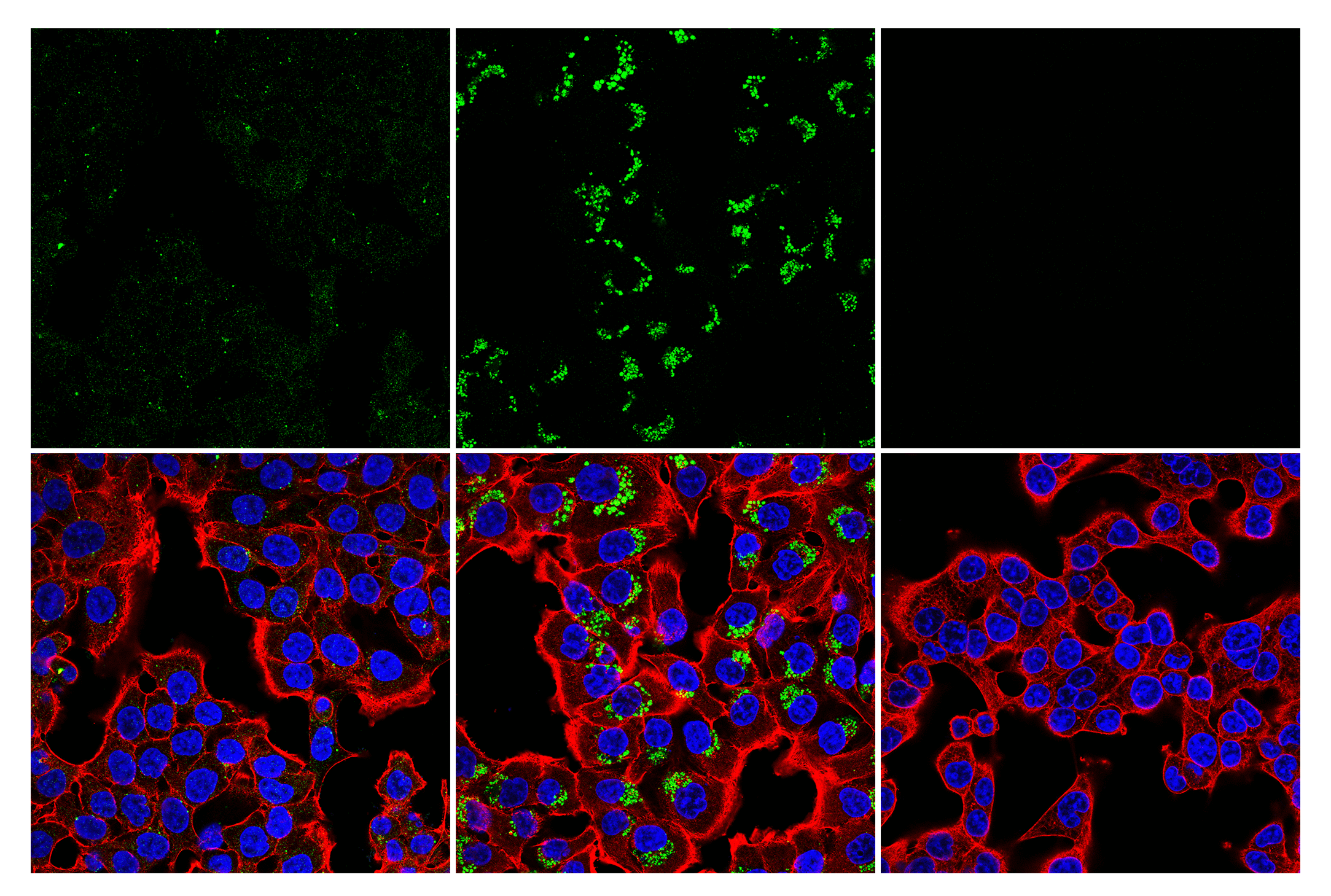 LC3B (E5Q2K) Mouse MAb (Alexa Fluor® 488 Conjugate) | Cell Signaling ...