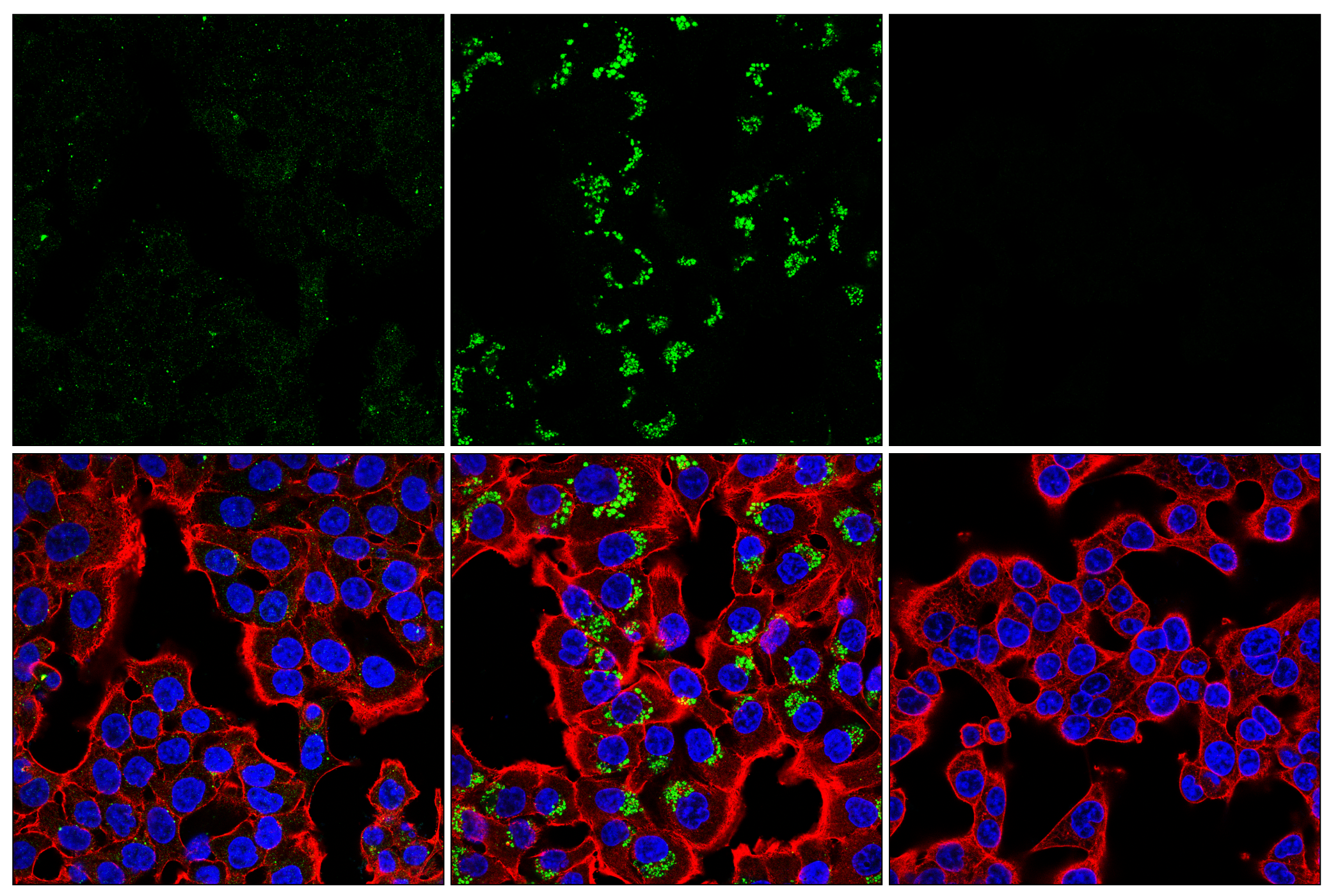 Immunofluorescence Image 2: LC3B (E5Q2K) Mouse mAb (Alexa Fluor® 488 Conjugate)