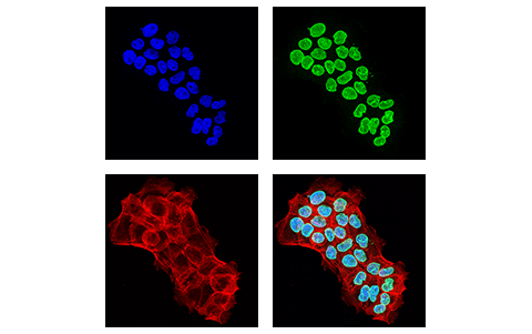 Immunofluorescence Image 1: NUP153 (E3I6Z) Rabbit mAb
