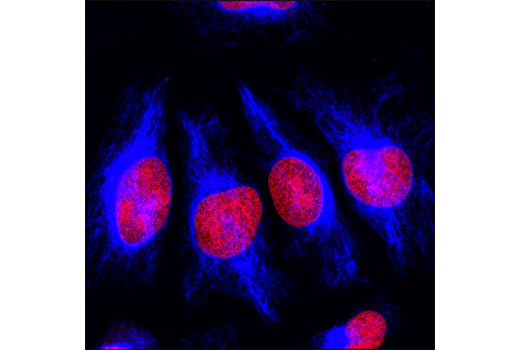 Immunofluorescence Image 1: Vimentin (D21H3) XP® Rabbit mAb (Alexa Fluor® 647 Conjugate)