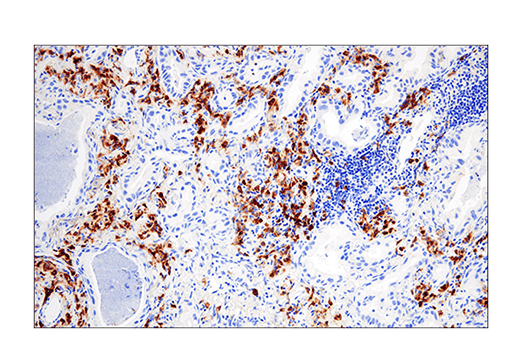 Immunohistochemistry Image 1: CRACC/SLAMF7/CD319 (E5C4M) Rabbit mAb