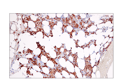 Immunohistochemistry Image 3: CRACC/SLAMF7/CD319 (E5C4M) Rabbit mAb