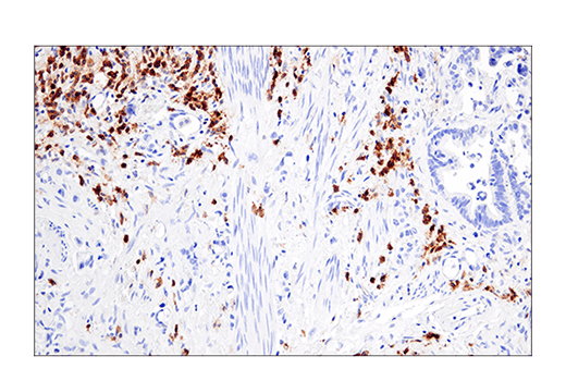 Immunohistochemistry Image 6: CRACC/SLAMF7/CD319 (E5C4M) Rabbit mAb