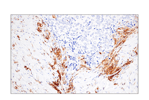 Immunohistochemistry Image 7: CRACC/SLAMF7/CD319 (E5C4M) Rabbit mAb