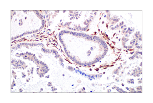 Immunohistochemistry Image 8: PTEN (138G6) Rabbit mAb (BSA and Azide Free)